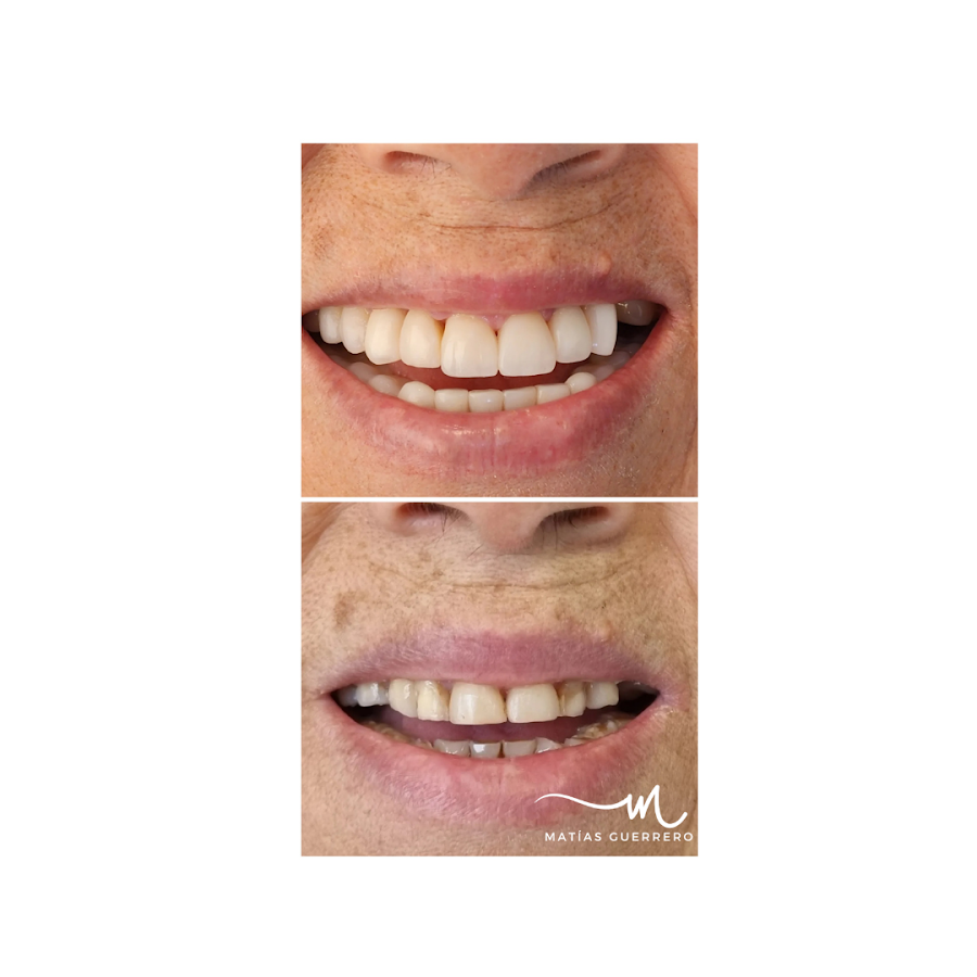 Matías Guerrero Dentista - dental clinic in Curicó, Chile