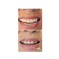 Matías Guerrero Dentista in Curicó, Chile