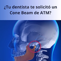 Imagé Radiografías Dentales Curicó