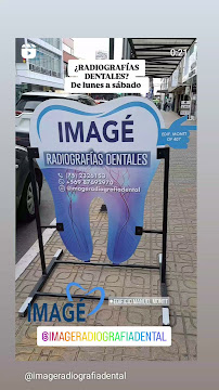 Imagé Radiografías Dentales Curicó