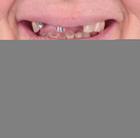 კრისტალდენტი - სტომატოლოგიური კლინიკა