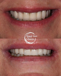 Total Charm Dental and Aesthetic Clinic