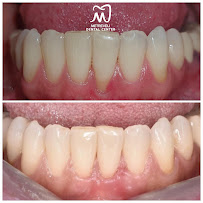 Anna Metreveli Dental Clinic | მეტრეველის სტომატოლოგიური კლინიკა