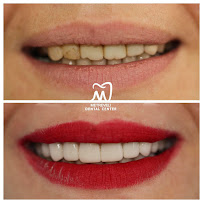 Anna Metreveli Dental Clinic | მეტრეველის სტომატოლოგიური კლინიკა