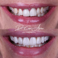 DENTISTA URGENCIAS DENTALES 24 HORAS CLINICA REALDENT CONDESA