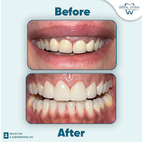 Dental Studio G.K დენტალ სტუდიო