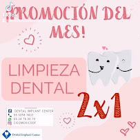 Implant Center Mexico City