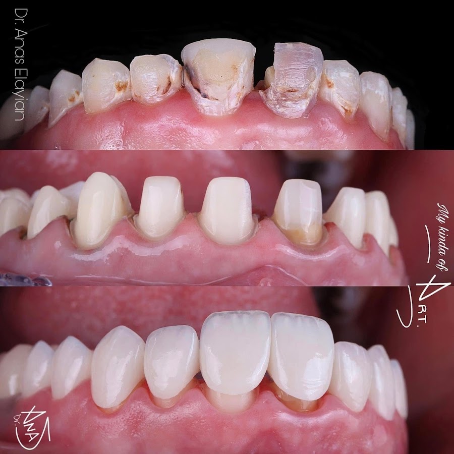 Nha Khoa Uy Tín Nha Trang - Nha Khoa Thẩm Mỹ Á Châu - dental clinic in Nha Trang