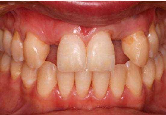 ProSmiles Dentist Collingwood - dental clinic in Melbourne, Australia