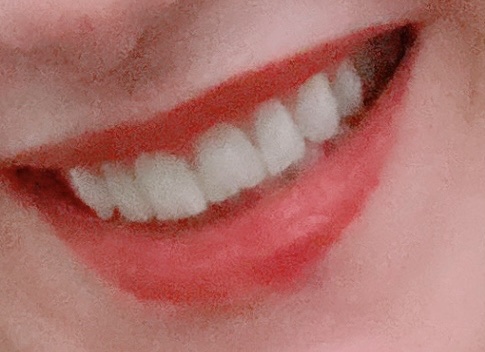 Dental Clinic Smiles Of Melbourne Toorak dental clinic in Melbourne