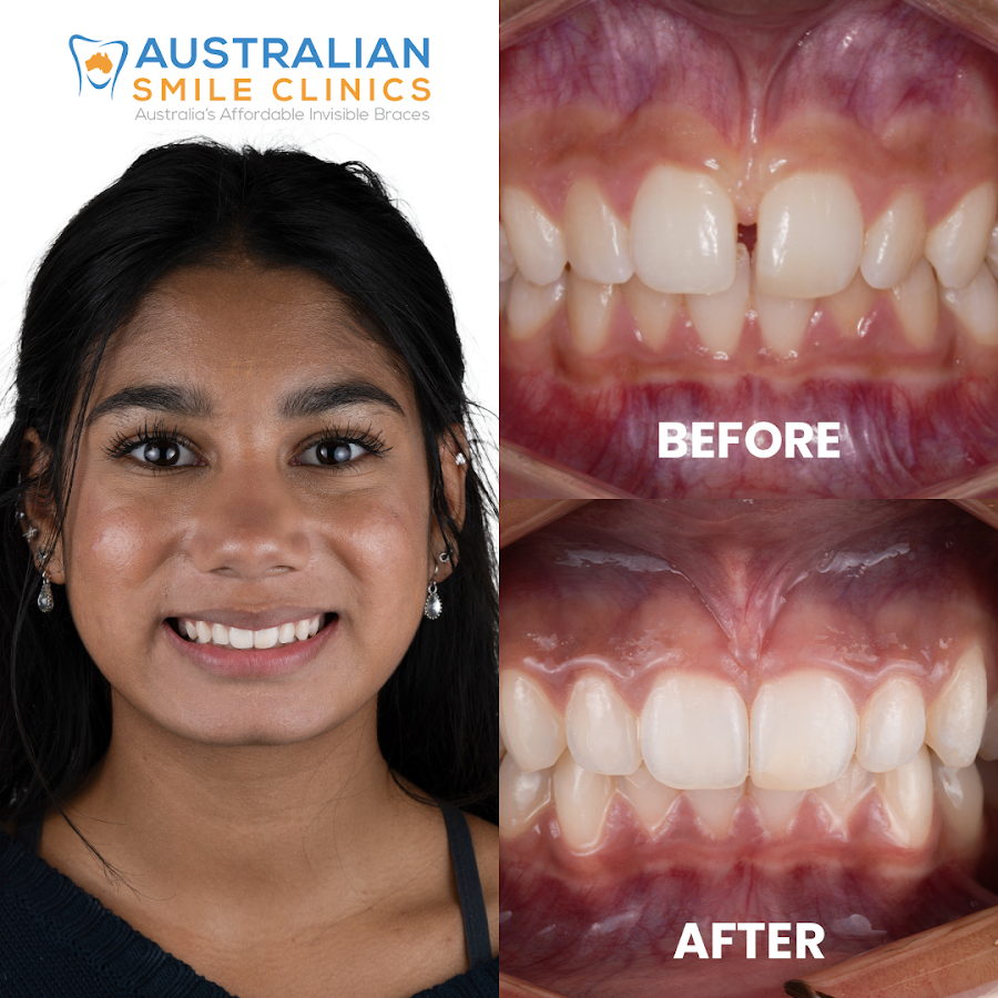 Australian Smile Clinics - dental clinic in Brisbane, Australia