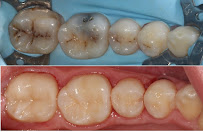 My Dentist at Cannon Hill