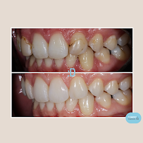 My Dentist at Cannon Hill