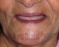 Dharahara Dental