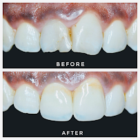 Smilemakers Dental Clinic Pvt. Ltd.
