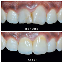 Smilemakers Dental Clinic Pvt. Ltd.