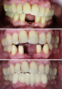 Smilemakers Dental Clinic Pvt. Ltd.