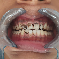 Shine Dental Clinic & Maxillofacial Care Center