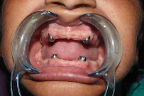 Shine Dental Clinic & Maxillofacial Care Center in Pokhara, Nepal
