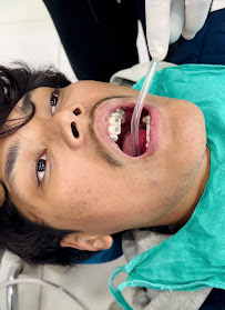 Miracle Pokhara Dental Hospital