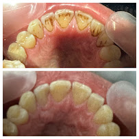 Dentista Polanco G&B Smile
