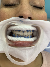 Dentista Polanco G&B Smile