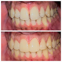 Everest Dental and Implant Center
