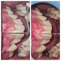 Everest Dental and Implant Center