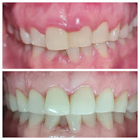 Everest Dental and Implant Center