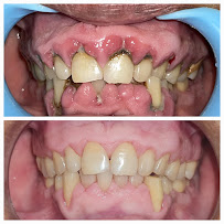 Everest Dental and Implant Center
