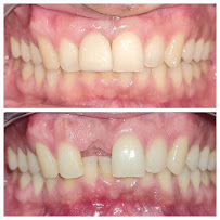 Everest Dental and Implant Center