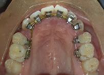 Dental Villa - Orthodontic Center and Speciality Dental Clinic