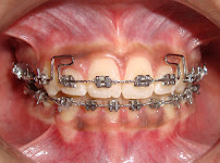 Dental Villa - Orthodontic Center and Speciality Dental Clinic
