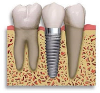 Dental Villa - Orthodontic Center and Speciality Dental Clinic