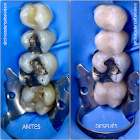 Clínica Dental Belodent plus