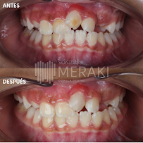 Sonrisas Meraki - Clínica Dental