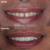 Sonrisas Meraki - Clínica Dental