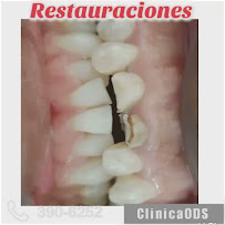 Clinica Dental & Ortodoncia O.D.S/ Dr. Eric Romero Ortodoncista de niños y adultos