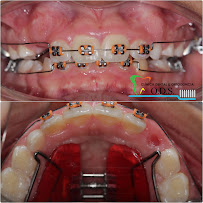 Clinica Dental & Ortodoncia O.D.S/ Dr. Eric Romero Ortodoncista de niños y adultos