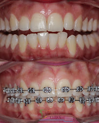 Clinica Dental & Ortodoncia O.D.S/ Dr. Eric Romero Ortodoncista de niños y adultos in Panama City