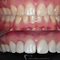 Clinica Dental & Ortodoncia O.D.S/ Dr. Eric Romero Ortodoncista de niños y adultos