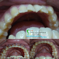 Clinica Dental & Ortodoncia O.D.S/ Dr. Eric Romero Ortodoncista de niños y adultos