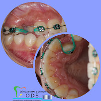 Clinica Dental & Ortodoncia O.D.S/ Dr. Eric Romero Ortodoncista de niños y adultos