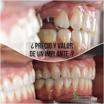 Clinica Dental & Ortodoncia O.D.S/ Dr. Eric Romero Ortodoncista de niños y adultos