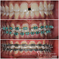 Clinica Dental & Ortodoncia O.D.S/ Dr. Eric Romero Ortodoncista de niños y adultos