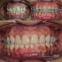 Clinica Dental & Ortodoncia O.D.S/ Dr. Eric Romero Ortodoncista de niños y adultos