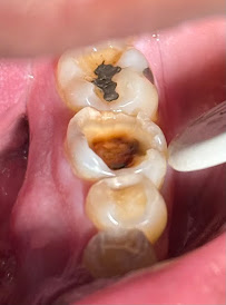 Clínica Dental Octavio Arosemena
