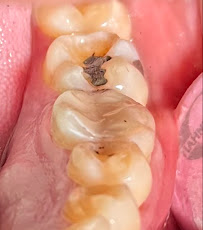 Clínica Dental Octavio Arosemena