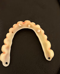 Implantus by Dr. Roland Zhuka - Dental Clinic in Tirana, Albania