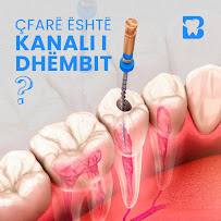 Best Dental Tirana